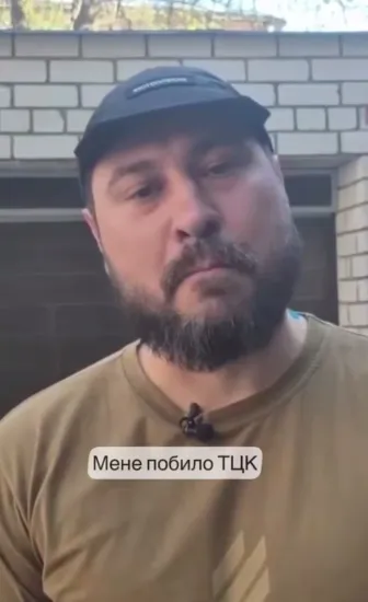 У Дніпрі розслідують заяву про побиття чоловіка за участю працівників ТЦК (ВІДЕО)