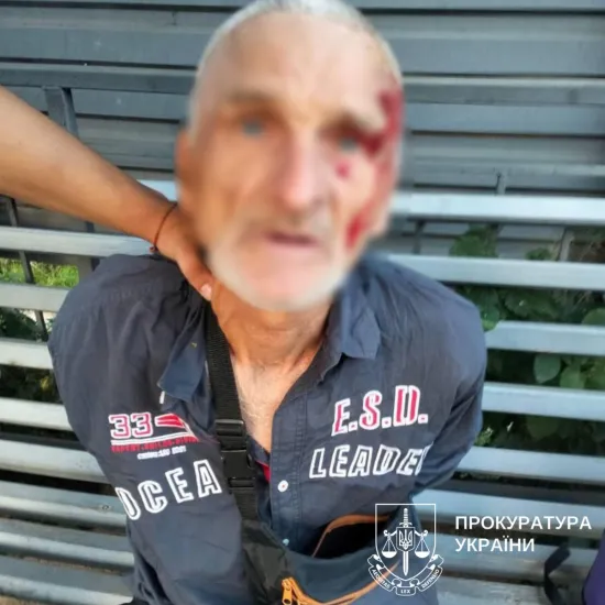 In Kyiv, a 60-year-old repeat offender was detained for rape and robbery assaults